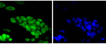 TCF7L2 antibody