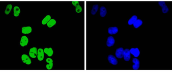 TCF7L2 antibody