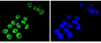 TCF7L2 antibody