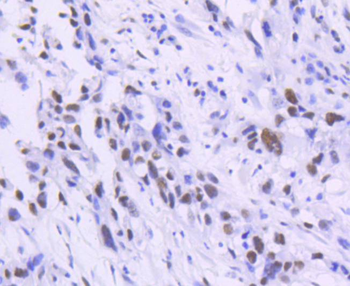 TCF7L2 antibody