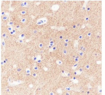 PRNP antibody