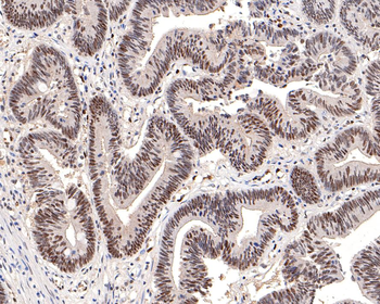 DNA PKcs antibody