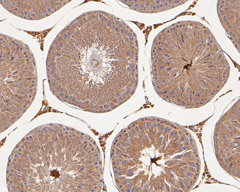 nNOS antibody