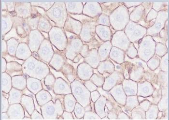 N Cadherin antibody