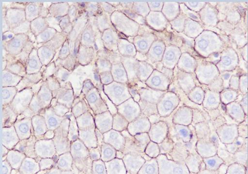 N Cadherin antibody