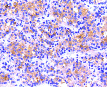 ITGB3 antibody