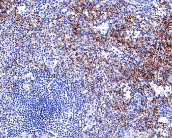 ITGB3 antibody