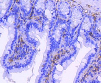 ITGB3 antibody