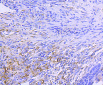 Hsp90 alpha antibody