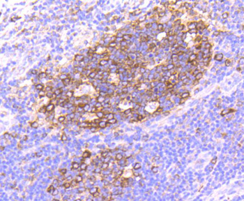 Hsp90 alpha antibody