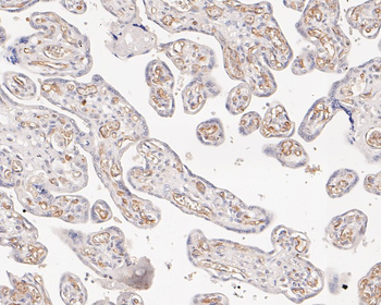 p16 ARC antibody