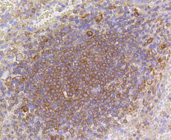 p16 ARC antibody