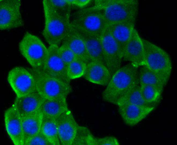 beta Tubulin antibody