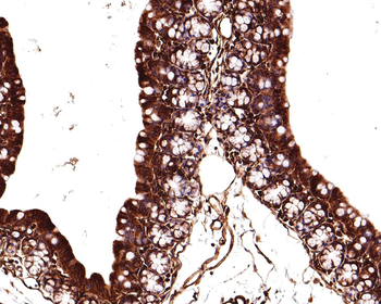 beta Tubulin antibody