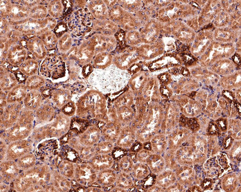 beta Tubulin antibody