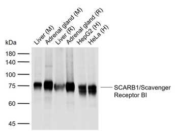 Scavenger Receptor BI antibody