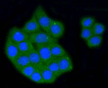 Scavenger Receptor BI antibody