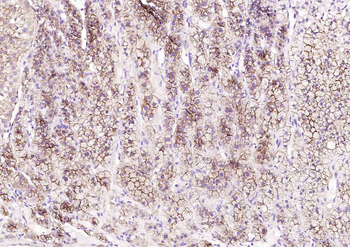 Scavenger Receptor BI antibody