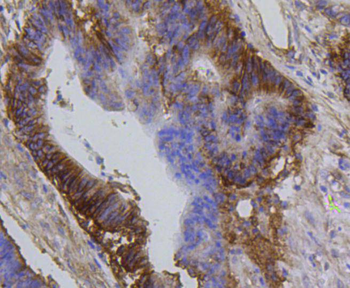 Integrin beta 1 antibody