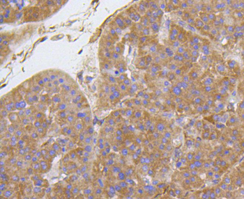 Integrin beta 1 antibody