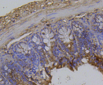 Integrin beta 1 antibody