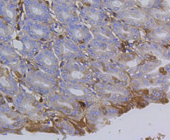 Integrin beta 1 antibody