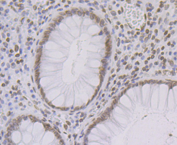 SUN2 antibody