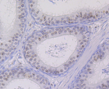 SUN2 antibody