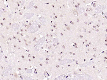 PPAR alpha antibody