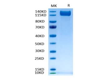 Human VEGFR2 Protein