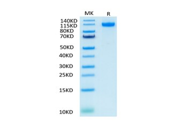 Human VEGFR1 Protein