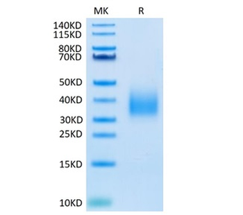 Human Trem2 Protein