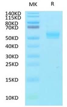 Human TGFBR2 Protein