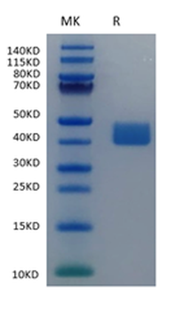 Human Mesothelin Protein