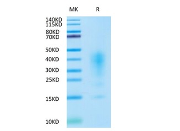 Human IL-13 Protein