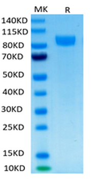 Human ErbB2 Protein