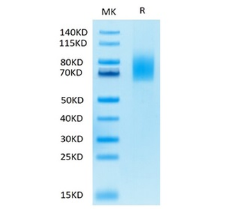 Human CD30 Protein