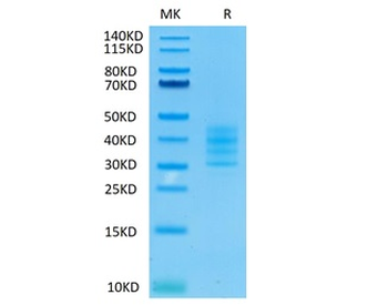 Human BCMA (Trimer) Protein