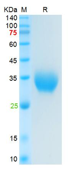 SARS-Cov-2 Spike RBD Protein