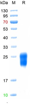 Recombinant human proBNP protein, N-His (HEK293)