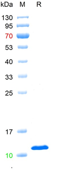 Human Beta-2-microglobulin Protein