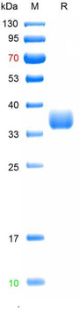 SARS-Cov-2 Protein