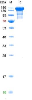 SARS-Cov-2 Protein