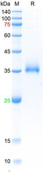 SARS-Cov-2 Spike RBD Protein