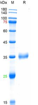 SARS-Cov-2 Spike RBD Protein