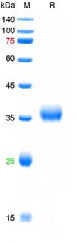 SARS-Cov-2 Spike RBD Protein