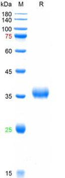 SARS-Cov-2 Spike RBD Protein