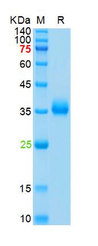 SARS-Cov-2 Spike RBD Protein