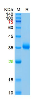 SARS-Cov-2 Spike RBD Protein