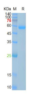 SARS-Cov-2 Spike RBD Protein